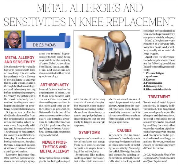 Metal Hypersensitivity After Joint Replacement Surgery: All You Need To Know