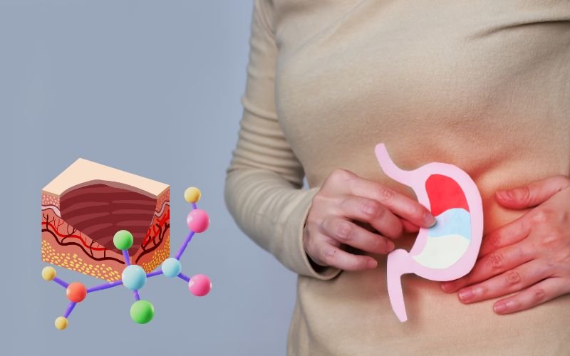 Is acid peptic disease dangerous gastroenterology hospital in delhi