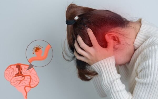 How Brain Hemorrhage is Treated? MRI, Survival Chances