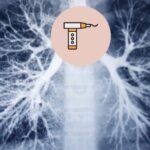 Bronchoscopy in delhi