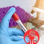 How much creatinine is safe for the kidneys