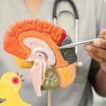 Is Hydrocephalus treatment possible without surgery? Explains best neurosurgeon in Delhi