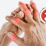 Can arthritis be cured permanently
