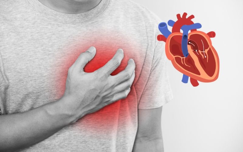 What is the treatment of congestive cardiac failure in Delhi