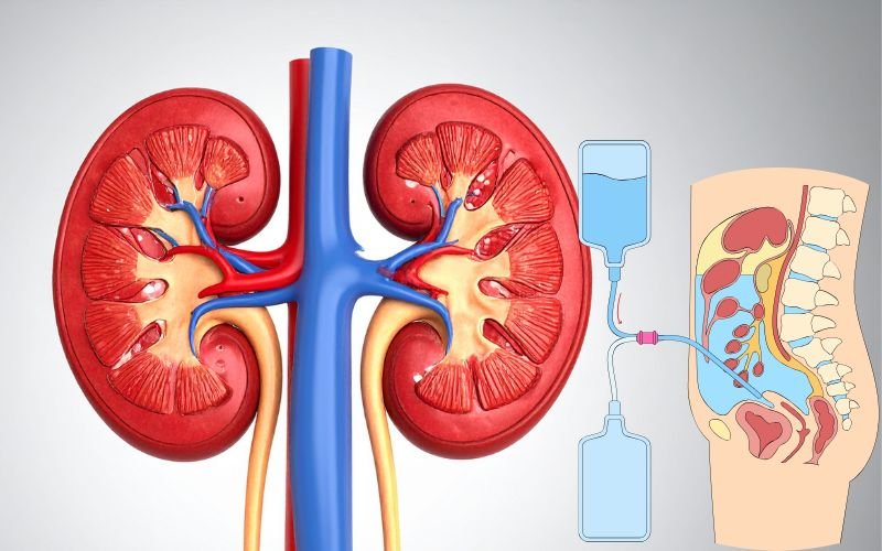 glomerulonephritis-treatment-at-nephrology-hospital-in-delhi