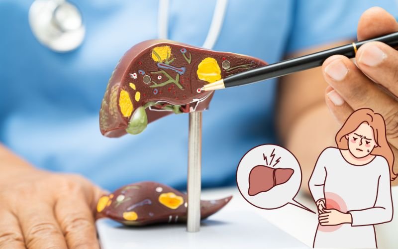 Is Fatty Liver Treatable Gastroenterology Hospital in Delhi