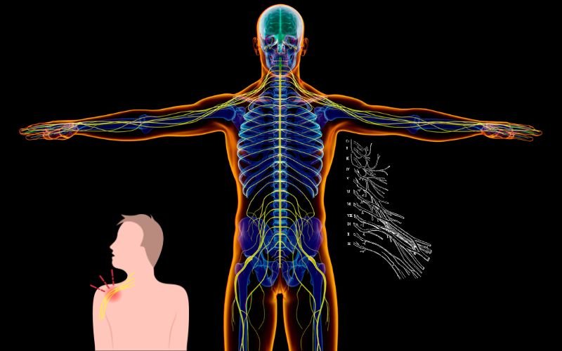 What is a brachial plexus injury treatment in Delhi