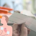 cardioversion surgery in Delhi at best heart hospital