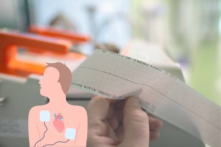 cardioversion surgery in Delhi at best heart hospital