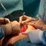 keyhole cardiac surgery hospital in Delhi (1)