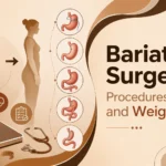 bariatric surgery procedures cost in delhi