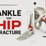 Ankle and Hip Fracture