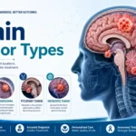 Brain Tumor Types treatment in Delhi