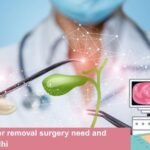Gallbladder removal surgery need and cost in Delhi