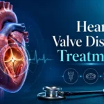 Heart Valve Disease treatment in Delhi