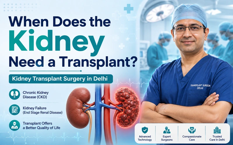 When Does the Kidney Need a Transplant? Kidney Transplant Surgery in Delhi