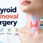 Thyroid Removal Surgery in Delhi