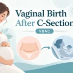 Vaginal Birth After C-Section